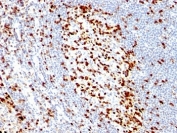 IHC: Formalin-fixed, paraffin-embedded human tonsil stained with ZAP70 antibody (clone ZAP70/528).