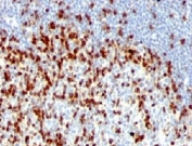 IHC: Formalin-fixed, paraffin-embedded human tonsil stained with ZAP70 antibody (clones ZAP70/528 + 2F3.2).