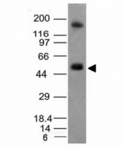 Western blot analysis of HCT116 cell lysate using CAIX antibody (CA9/781). Predicted molecular weight: 50-55 kDa.