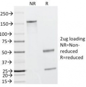 SDS-PAGE Analysis of Purified, BSA-Free CAD Antibody (clone h-CALD). Confirmation of Integrity and Purity of the Antibody.