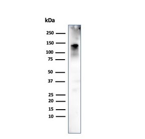 Western blot testing of human ovary tissue with CAD antibody (clone h-CALD). Predicted molecular weight ~93 kDa, can be observed at 70-80 kDa (non muscle tissue) and 120-150 kDa (smooth muscle).~