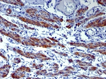 IHC: Formalin-fixed, paraffin-embedded human uterus stained with CAD antibody (h-CALD).~