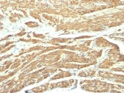 IHC: Formalin-fixed, paraffin-embedded human uterus stained with Caldesmon antibody (clone SPM168).