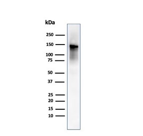 Western blot testing of human ovary tissue lysate using Caldesmon antibody (clone SPM168). Predicted molecular weight ~93 kDa, can be observed at 70-80 kDa (non muscle tissue) and 120-150 kDa (smooth muscle).~