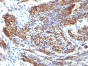 IHC: Formalin-fixed, paraffin-embedded human uterus stained with CAD antibody (CALD1/820).