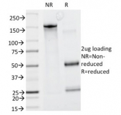 SDS-PAGE analysis of purified, BSA-free CAD antibody (clone CALD1/820) as confirmation of integrity and purity.