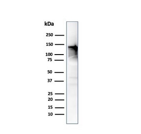 Western blot testing of human ovary tissue lysate using CAD antibody (clone CALD1/820). Predicted molecular weight ~93 kDa, can be observed at 70-80 kDa (non muscle tissue) and 120-150 kDa (smooth muscle).~