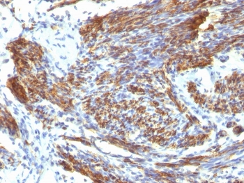 IHC: Formalin-fixed, paraffin-embedded human uterus stained with CAD antibody (CALD1/820).~
