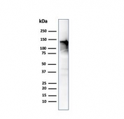 Western blot testing of human ovary tissue lysate using CAD antibody (clone CALD1/820). Predicted molecular weight ~93 kDa, can be observed at 70-80 kDa (non muscle tissue) and 120-150 kDa (smooth muscle).