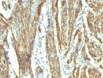 IHC: Formalin-fixed, paraffin-embedded human uterus stained with CAD antibody (CALD1/820 + h-CALD).
