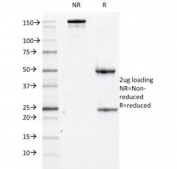 SDS-PAGE Analysis of Purified, BSA-Free CD84 Antibody (clone 152-1D5). Confirmation of Integrity and Purity of the Antibody.