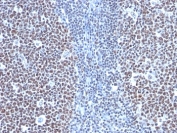 IHC: Formalin-fixed, paraffin-embedded human tonsil stained with CCNB1 antibody (clone SPM619).