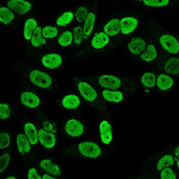 Immunofluorescent staining of PFA-fixed human HeLa cells with CCNB1 antibody (clone SPM619).~