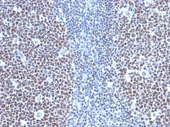 IHC: Formalin-fixed, paraffin-embedded human tonsil stained with CCNB1 antibody (SPM619)