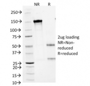SDS-PAGE Analysis of Purified, BSA-Free CD1a Antibody (clone 66IIC7). Confirmation of Integrity and Purity of the Antibody.