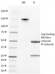 SDS-PAGE analysis of purified, BSA-free CD2 antibody (clone LFA2/600) as confirmation of integrity and purity.