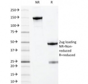 SDS-PAGE Analysis of Purified, BSA-Free MYADM Antibody (clone MYADM/971). Confirmation of Integrity and Purity of the Antibody.