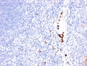 IHC: Formalin-fixed, paraffin-embedded human tonsil stained with MYDAM antibody (clone MYADM/971).