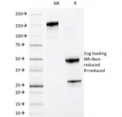 SDS-PAGE Analysis of Purified, BSA-Free Myeloid Antibody (clone MYADM/972). Confirmation of Integrity and Purity of the Antibody.