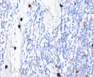 IHC: Formalin-fixed, paraffin-embedded human tonsil stained with Myeloid antibody (clone MYADM/972).~
