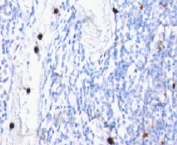 IHC: Formalin-fixed, paraffin-embedded human tonsil stained with Myeloid antibody (clone MYADM/972).