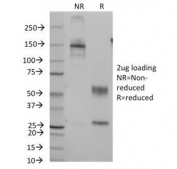 SDS-PAGE Analysis of Purified, BSA-Free CD7 Antibody (clone B-F12). Confirmation of Integrity and Purity of the Antibody.