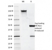 SDS-PAGE Analysis of Purified, BSA-Free CD7 Antibody (clone 124-1D1). Confirmation of Integrity and Purity of the Antibody.