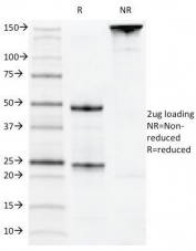 SDS-PAGE Analysis of Purified, BSA-Free CD22 Antibody (clone MYG13). Confirmation of Integrity and Purity of the Antibody.