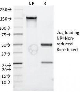 SDS-PAGE Analysis of Purified, BSA-Free CD30 Antibody (clone Ki-1/779). Confirmation of Integrity and Purity of the A