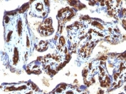 IHC: Formalin-fixed, paraffin-embedded human placenta stained with CD34 antibody (HPCA1/763)