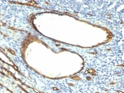 IHC: Formalin-fixed, paraffin-embedded human tonsil stained with CD34 antibody (HPCA1/763)
