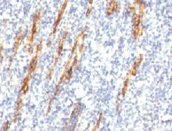 IHC: Formalin-fixed, paraffin-embedded human tonsil stained with CD34 antibody (QBEnd/10 + HPCA1/763)~
