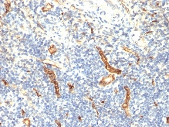 IHC: Formalin-fixed, paraffin-embedded human tonsil stained with anti-CD34 antibody (HPCA1/1171)~