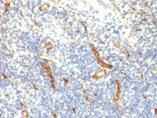 IHC: Formalin-fixed, paraffin-embedded human tonsil stained with anti-CD34 antibody (HPCA1/1171)