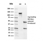 SDS-PAGE analysis of purified, BSA-free CD34 antibody (clone SPM610) as confirmation of integrity and purity.