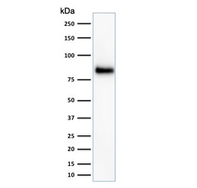 Western blot testing of HeLa cell lysate with HCAM antibody (clone HCAM/918). Predicted molecular weight ~81 kDa.~