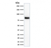Western blot testing of HeLa cell lysate with HCAM antibody (clone HCAM/918). Predicted molecular weight ~81 kDa.