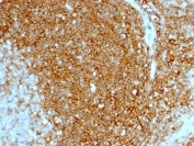 IHC: Formalin-fixed, paraffin-embedded human tonsil stained with HCAM antibody (HCAM/1097)