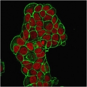 Immunofluorescent staining of PFA-fixed human MCF7 cells with CD47 antibody (green, clone IAP/964) and Reddot nuclear stain (red).