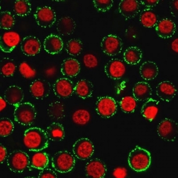 Immunofluorescent staining of live human Jurkat cells with CD47 antibody (green, clone IAP/964) and Reddot nuclear stain (red).~