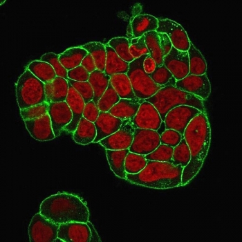 Immunofluorescent staining of PFA-fixed human MCF-7 cells with CD47 antibody cocktail (green, clones B6H12.2 + IAP/964) and Reddot nuclear stain (red).