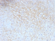 Formalin-fixed, paraffin-embedded human tonsil stained with CD59 antibody (MACIF/629)