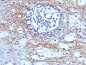 Formalin-fixed, paraffin-embedded human tongue stained with CD59 antibody (MACIF/629)