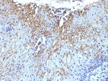 IHC: Formalin-fixed, paraffin-embedded human tongue stained with CD59 antibody (SPM616)