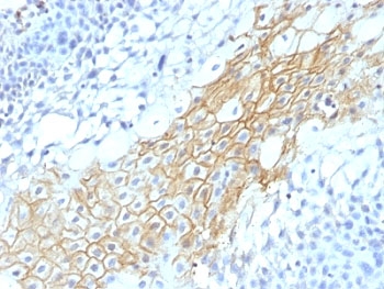 IHC: Formalin-fixed, paraffin-embedded human tongue stained with CD59 antibody (MACIF/1193)