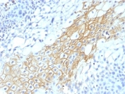 IHC: Formalin-fixed, paraffin-embedded human tongue stained with CD59 antibody (MACIF/1193)