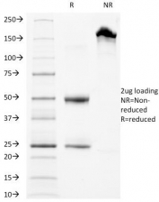 SDS-PAGE Analysis of Purified, BSA-Free LAMP-3 Antibody (clone LAMP3/968). Confirmation of Integrity and Purity of the Antibody.