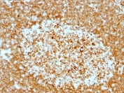 IHC: Formalin-fixed, paraffin-embedded human tonsil stained with CD74 antibody (LN-2 + CLIP/813).