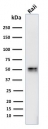 Western blot testing of human Raji cell lysate with CD79a antibody (clone IGA/764). Expected molecular weight: 25-47 kDa depending on glycosylation level.