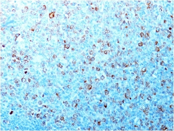 IHC testing of formalin-fixed, paraffin-embedded human tonsil with CDC2 antibody (CDK1/873). Staining of formalin-fixed tissues requires boiling tissue sections in pH 9 10mM Tris with 1mM EDTA for 10-20 min followed by cooling at RT for 20 min.~